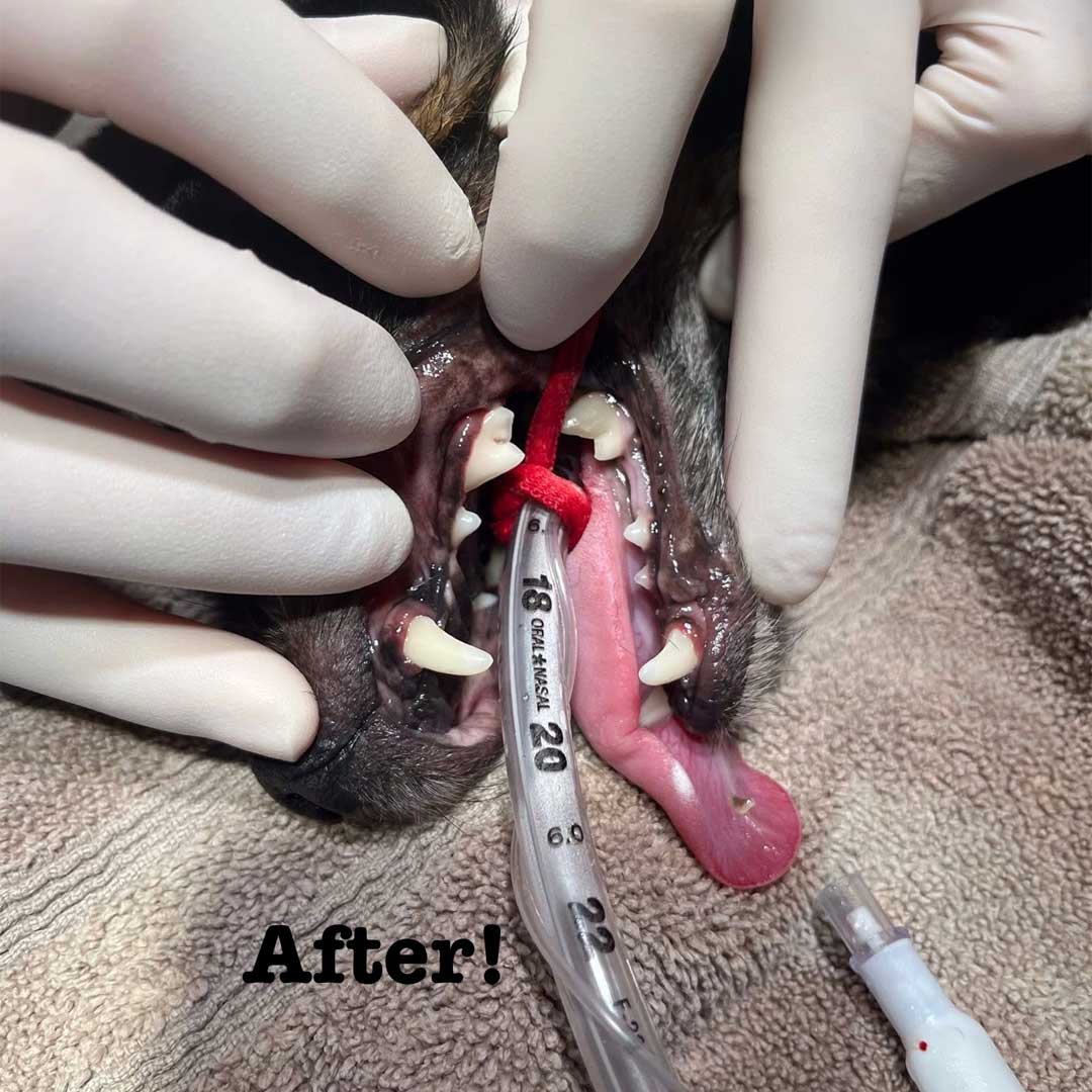 Dental-Pic-After Dental Surgery after